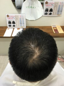 Ｍ１ヘアケアローション